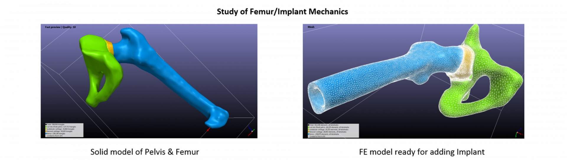 femur implant 01